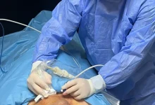 SAĞLIK Devasa büyüklükteki guatr ameliyatsız tedavi edildi
