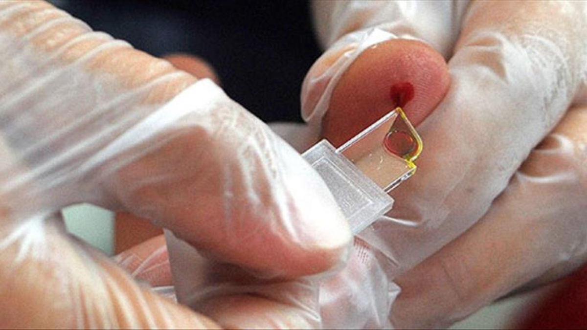 Nadir Rh-null Kan Grubu Laboratuvar Ortamında Üretiliyor